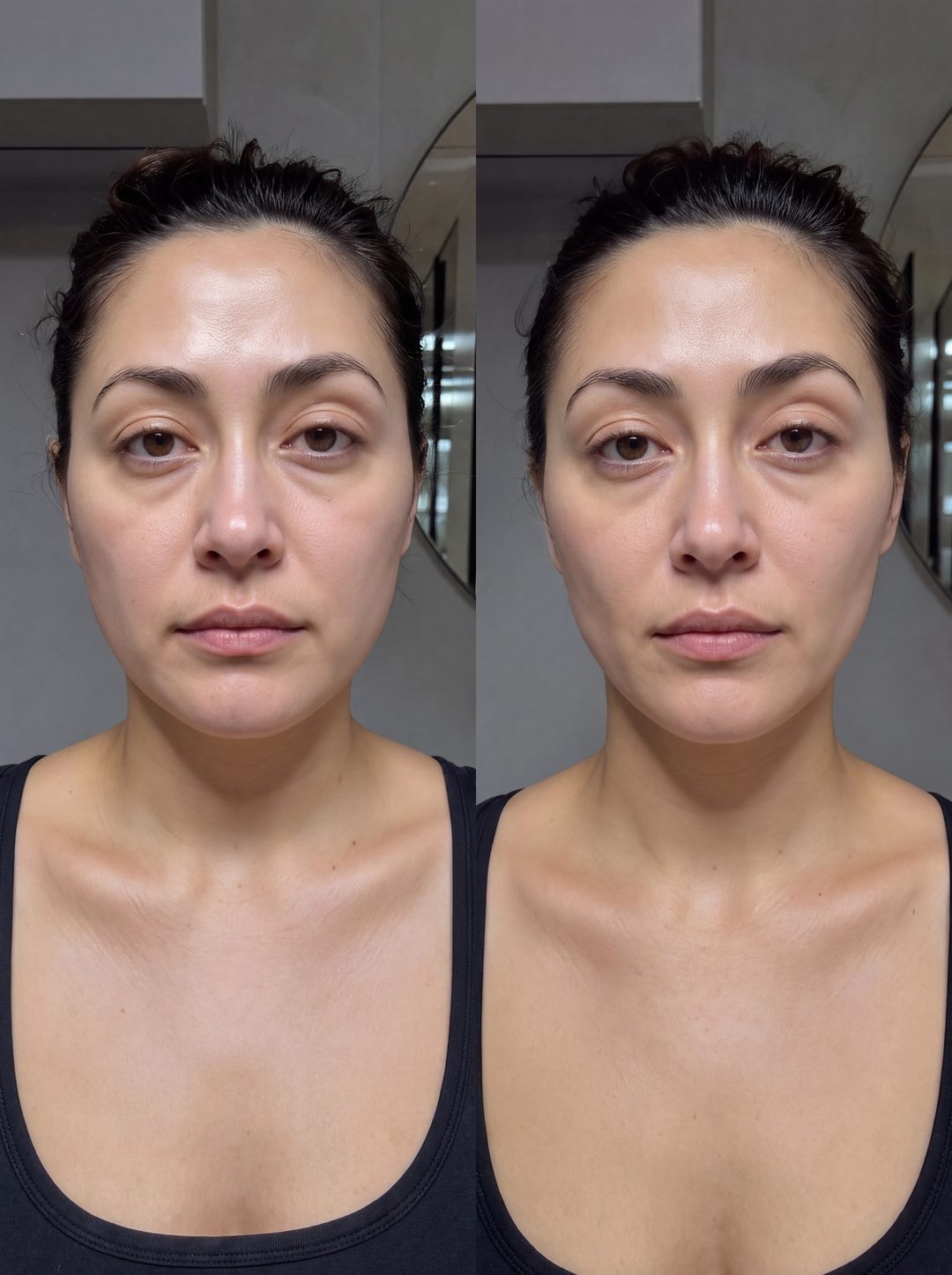 Before and after with Nova — Jaw and under-eyes de-puffed — a lighter face by morning.