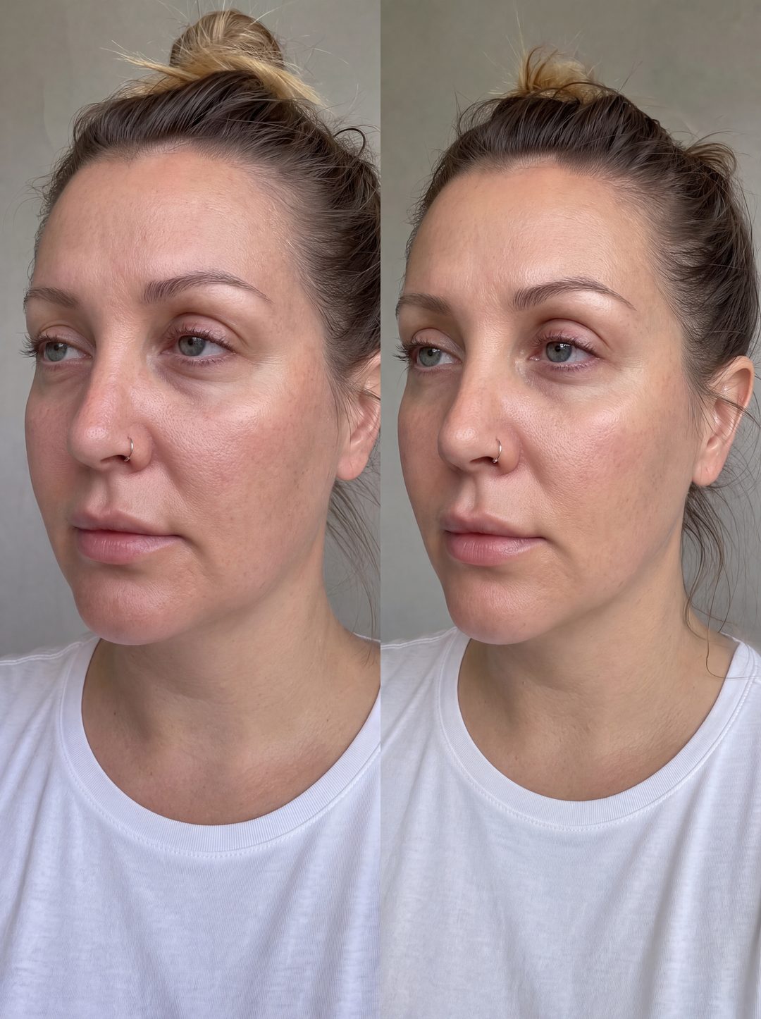 Before and after with Nova — The perimenopause puff, handled — a lighter face by morning.