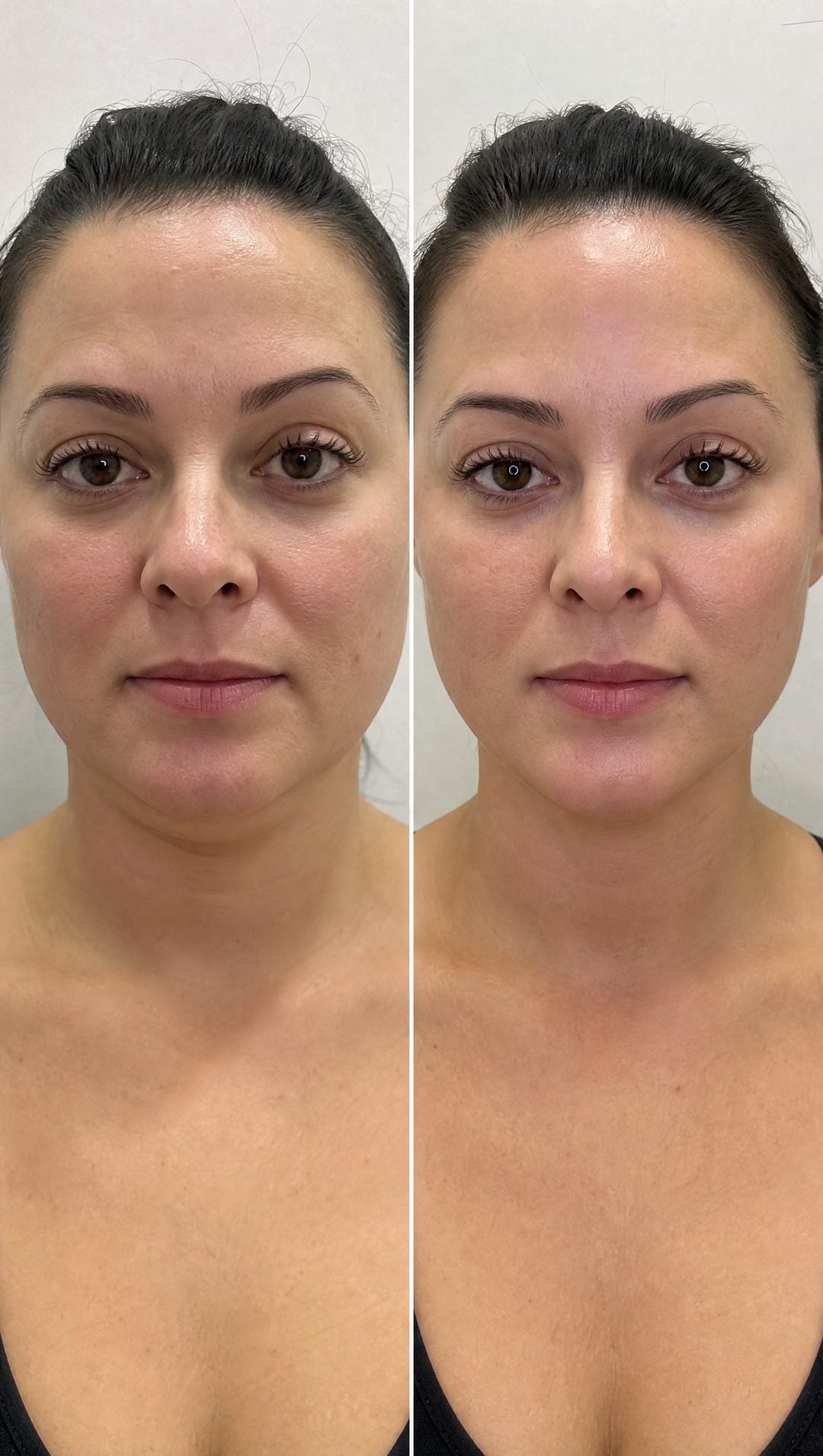 Before and after — A lighter, fresher-looking face — evenings well spent.