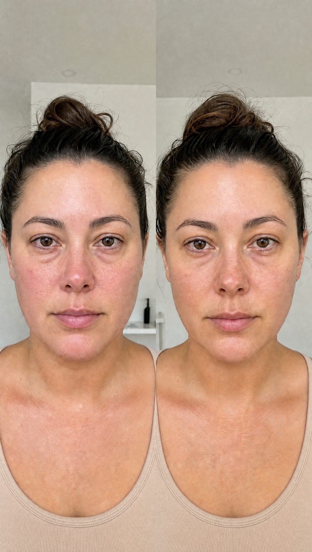 Before and after — Less facial water retention — smoother-looking skin.