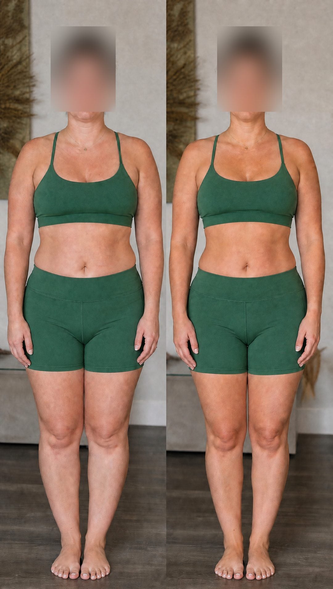 Before and after — End-of-day heaviness down, visibly less fluid.